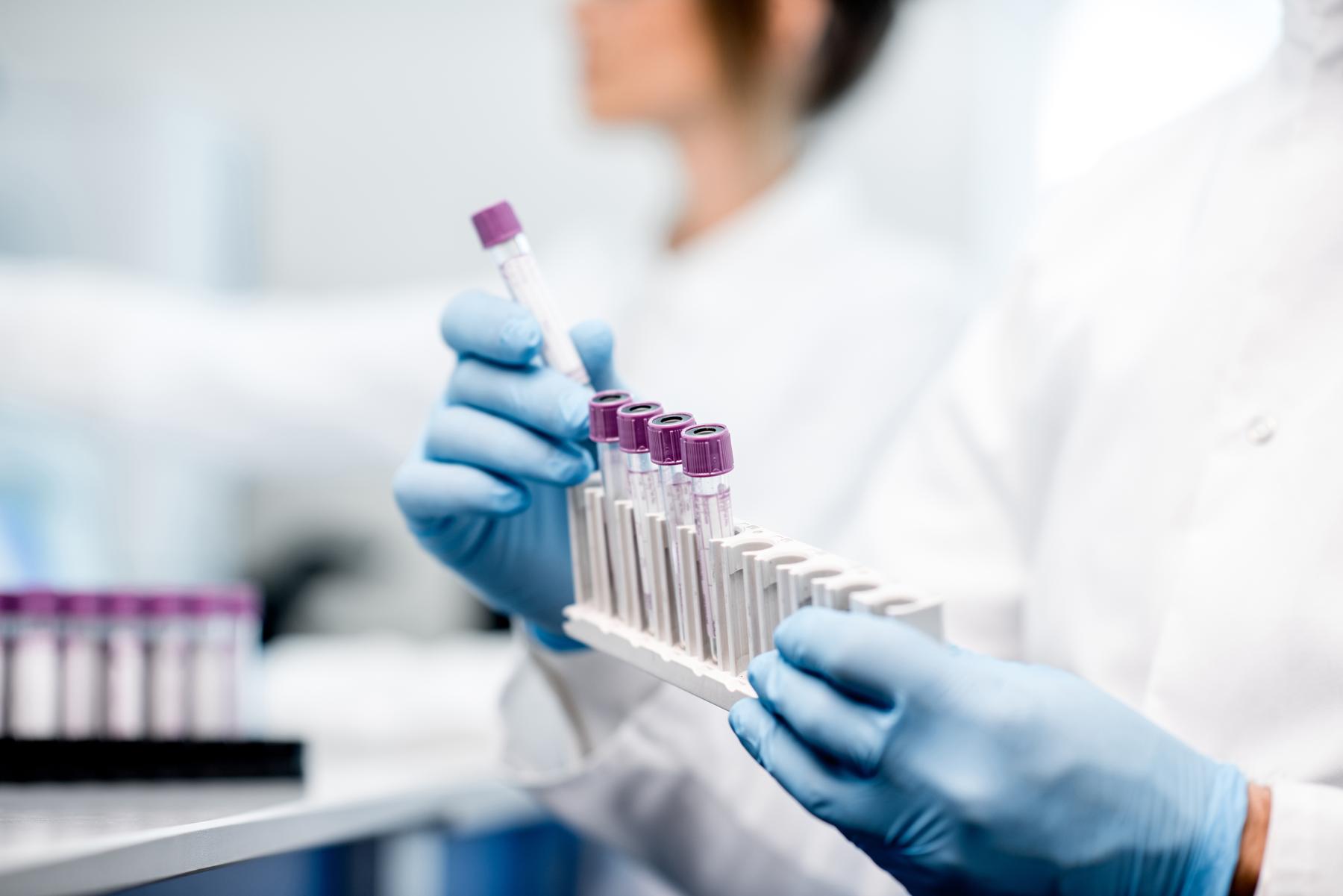 Gloved hands holding a rack of labelled blood sample tubes in a laboratory